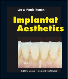 Luc & Patrick Rutten Implant Aesthetics book